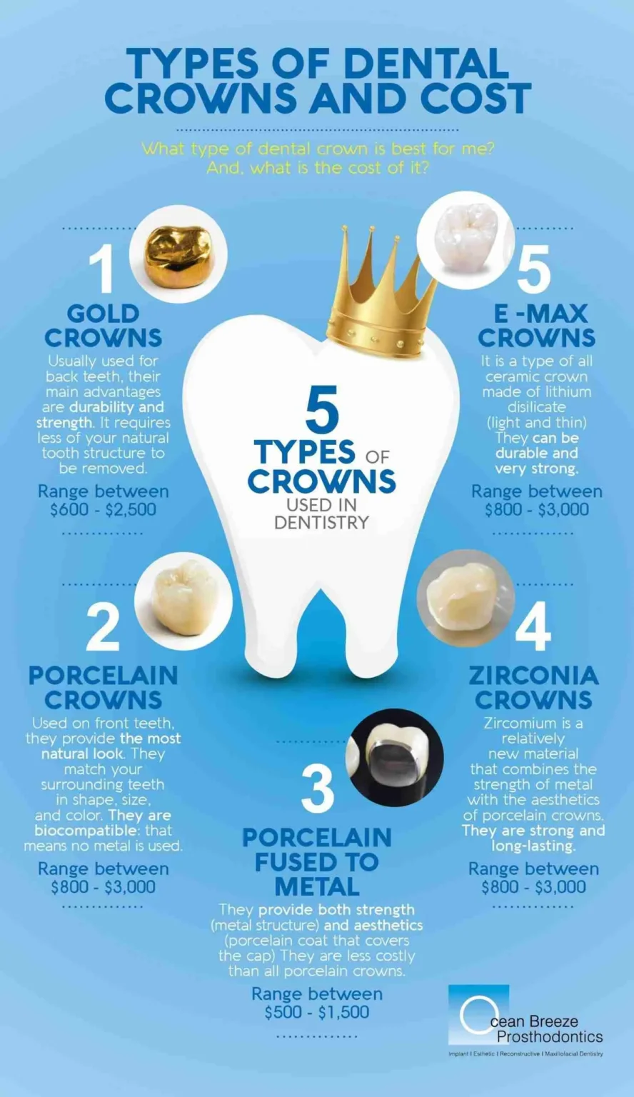 Why is getting a crown so expensive?