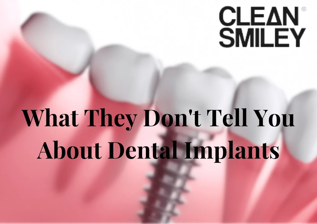 What don't they tell you about implants?